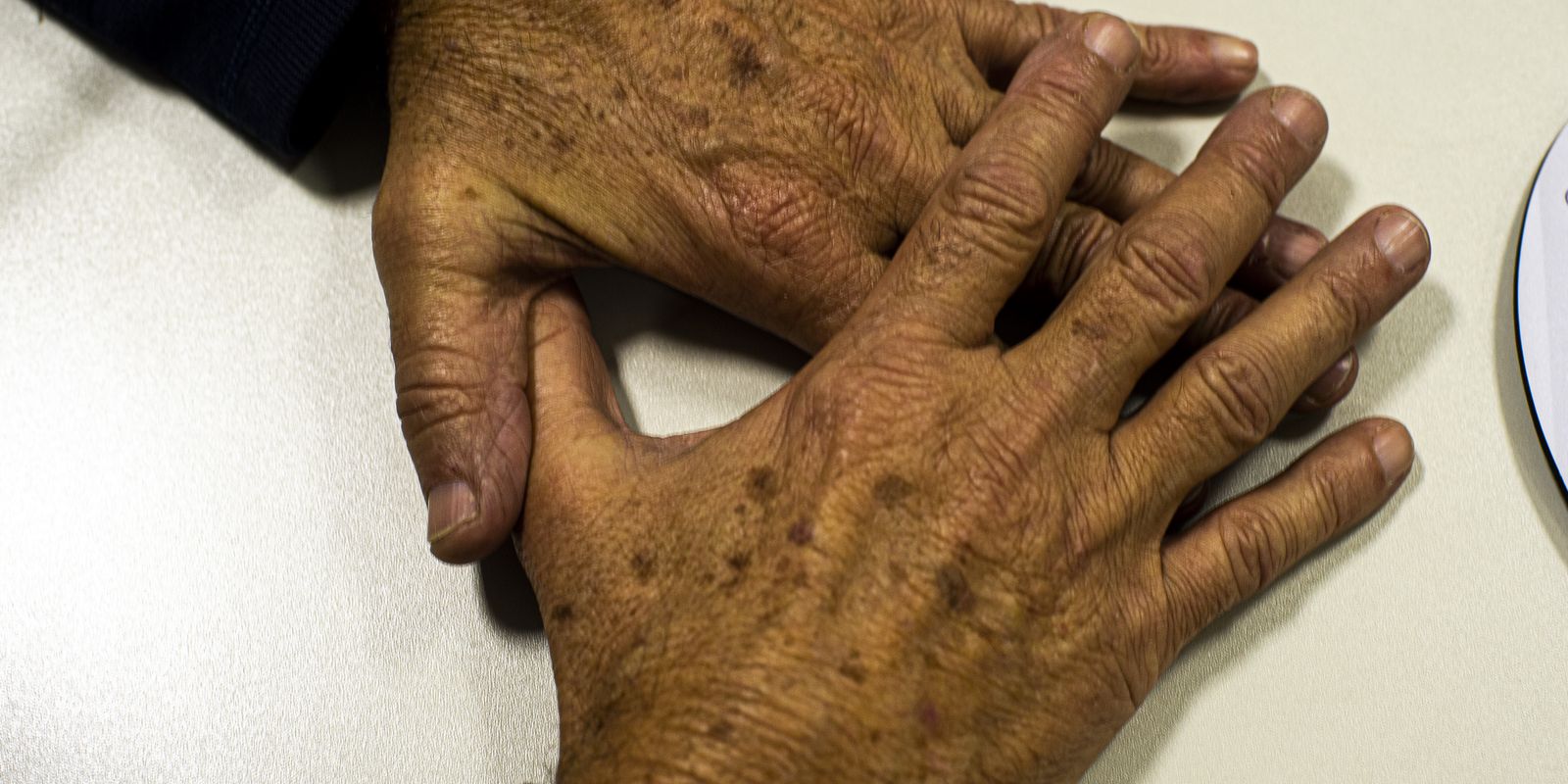 Brasil projeta 781 mil novos casos de câncer por ano até 2028